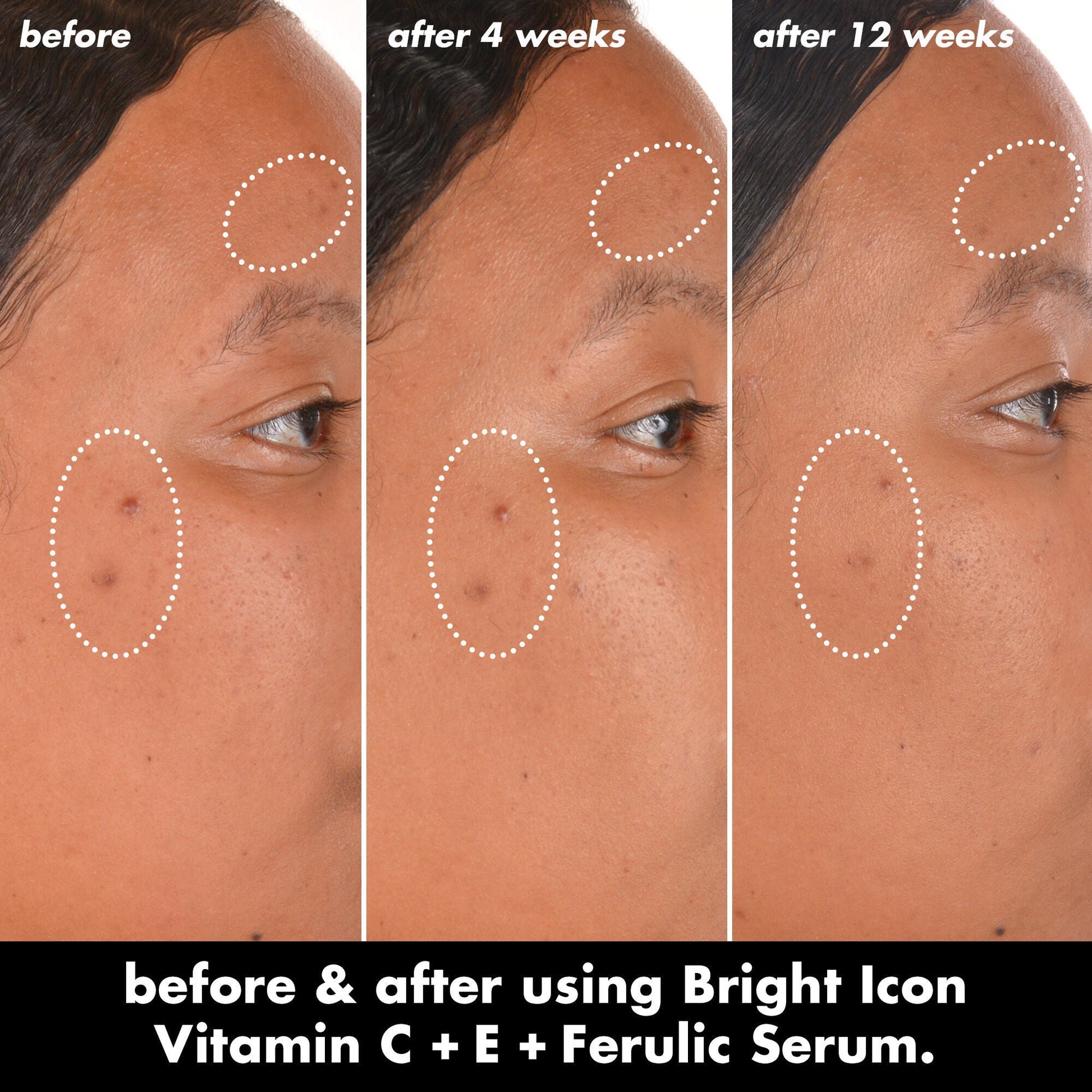 bright-icon-vitamin-c-e-ferulic-serum-j8 0226_EDU_BrightIconVitC_BA_Chanel_TRIPTYCH_c58f2fc8-209d-414f-9ba3-666a07a94887.jpg