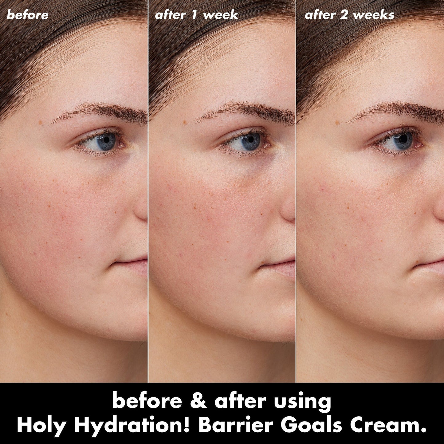 holy-hydration-barrier-goals-cream-mini-c0 0226_EDU_HHBarrierGoalsCream_B_A_Zoe_TRYPTICH_4f0e5b5d-35fb-4020-968e-244d4536afbd.jpg