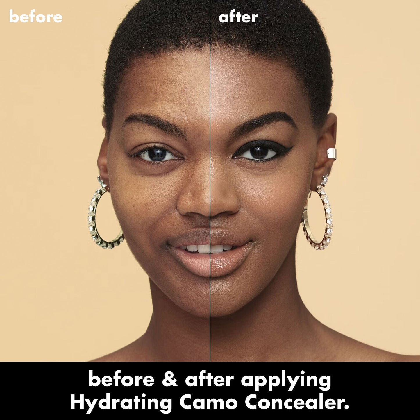 hydrating-camo-concealer-x6 0226_EDU_HydratingCamoConcelaer_BA_AshleyKaresh_20_1_d8499bbf-0e91-4173-b5e2-75127caf83a3.jpg