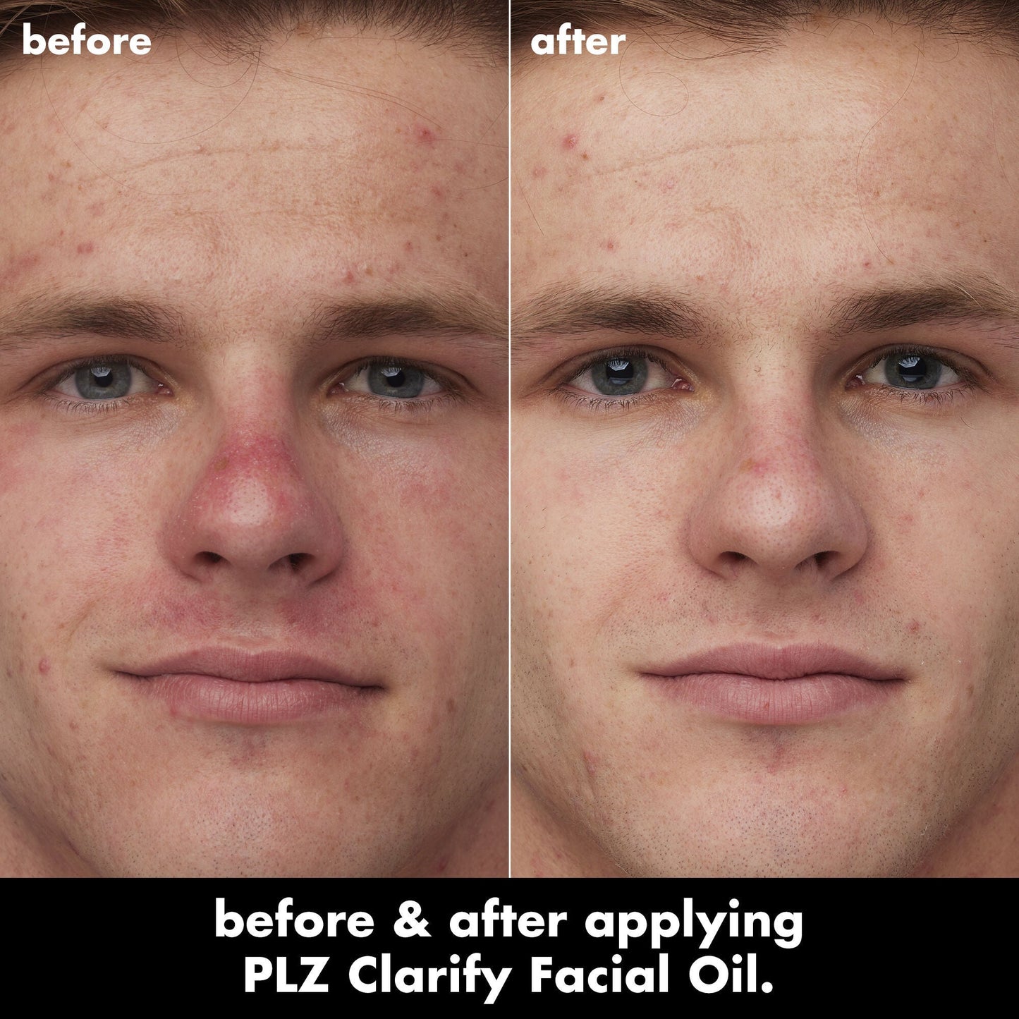 plz-clarify-facial-oil-e7 0326_EDU_PlzClarify_BA_Caleb.jpg