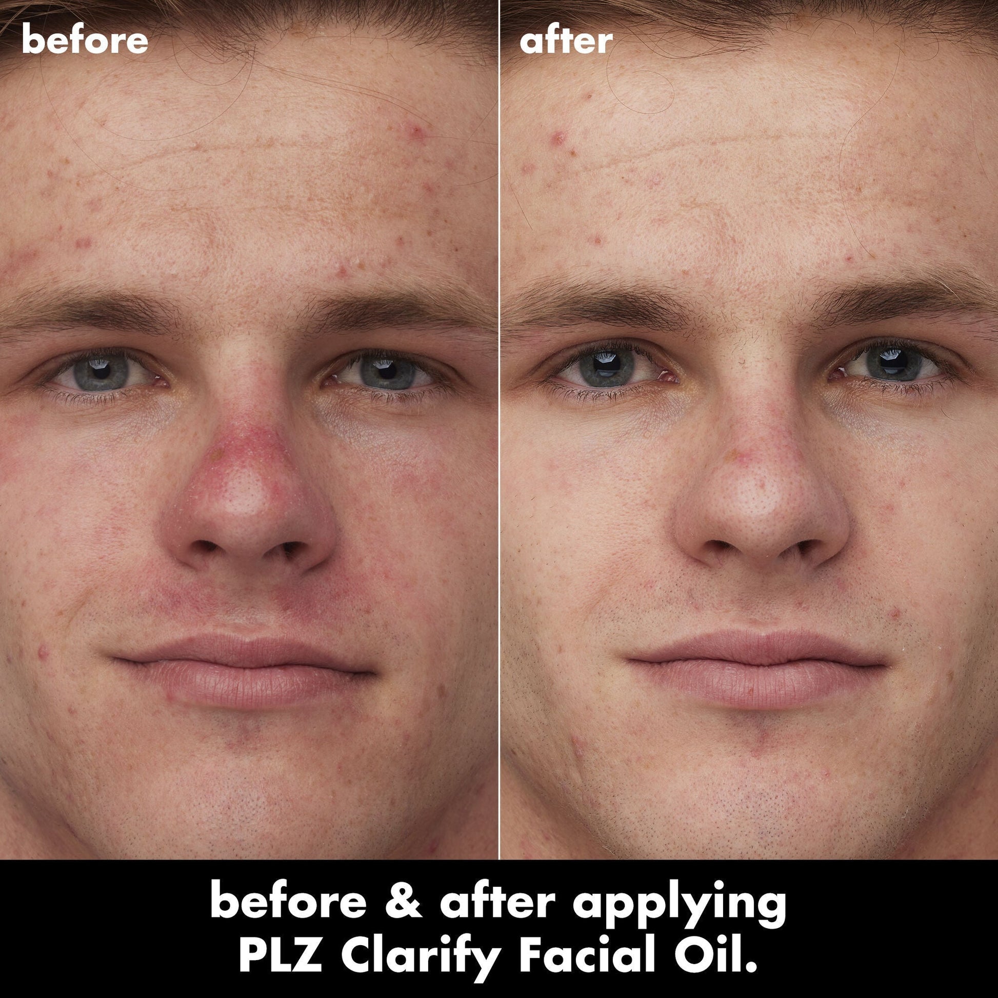 plz-clarify-facial-oil-e7 0326_EDU_PlzClarify_BA_Caleb.jpg