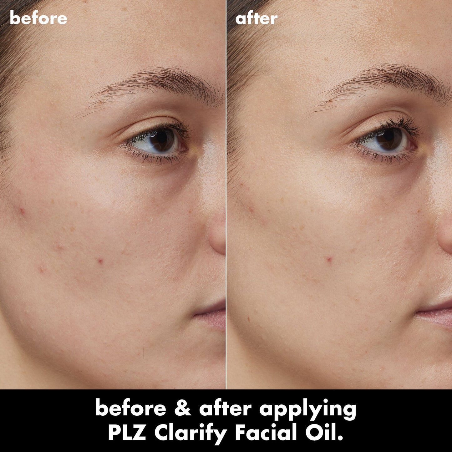 plz-clarify-facial-oil-e7 0326_EDU_PlzClarify_BA_Kelly.jpg