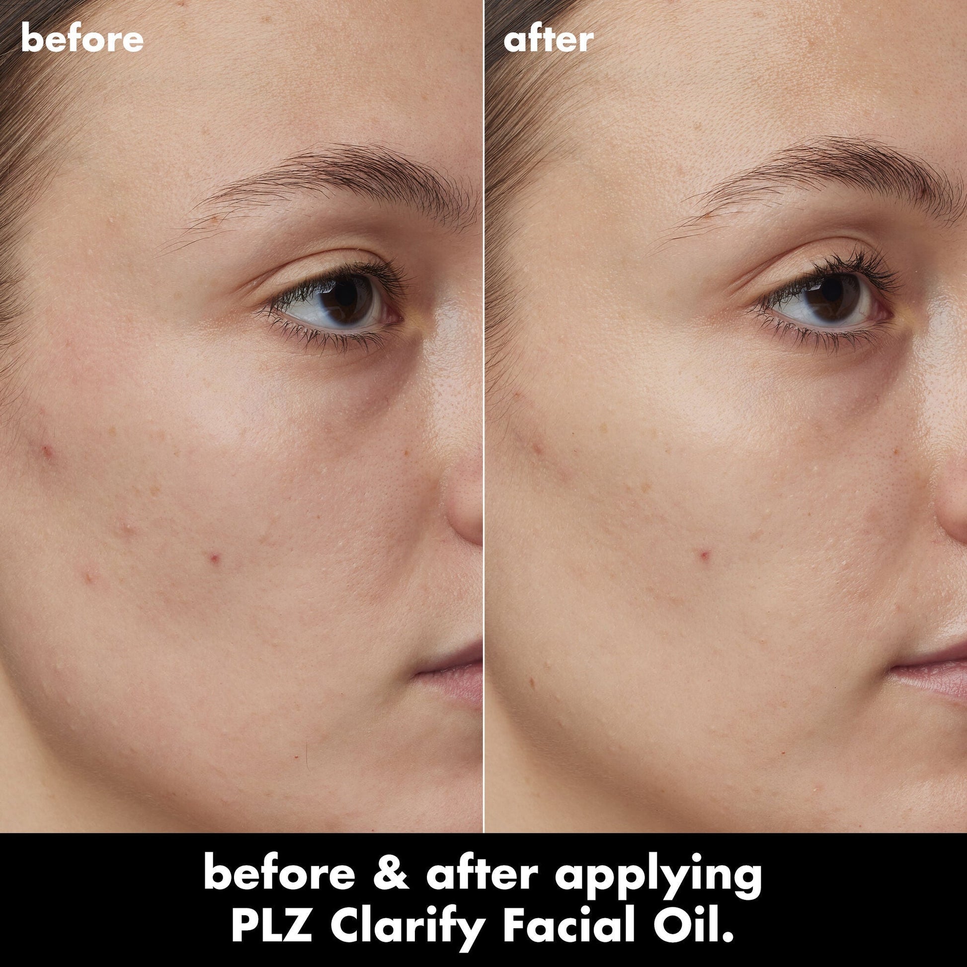 plz-clarify-facial-oil-e7 0326_EDU_PlzClarify_BA_Kelly.jpg