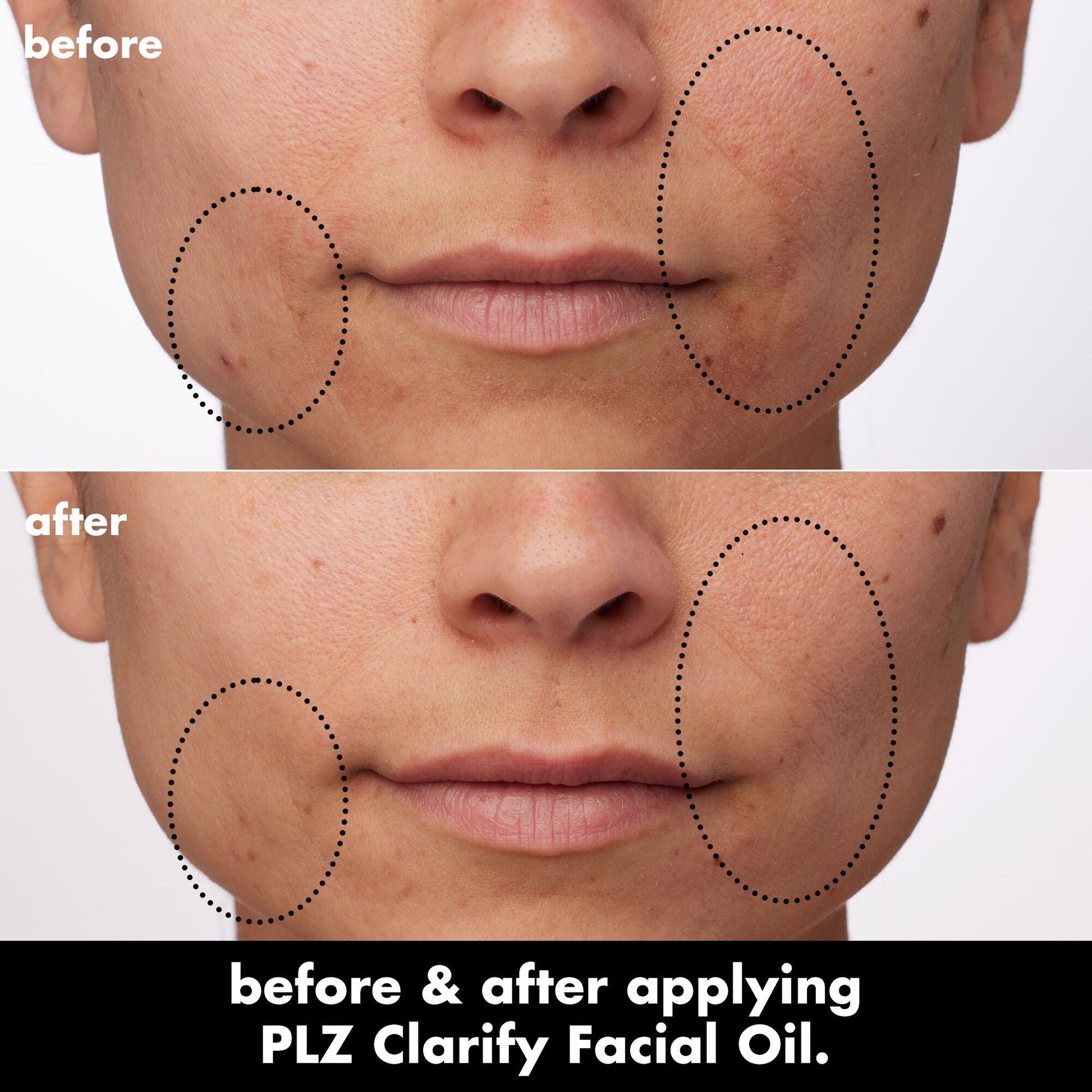 plz-clarify-facial-oil-e7 0326_EDU_PlzClarify_BA_Paula.jpg