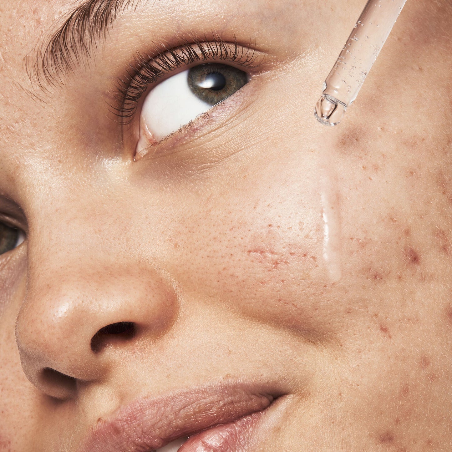 blemish-breakthrough-triple-acid-resurfacing-serum-x2 121321_Marley-Acne-Regimen_0254_FINAL_IGF.jpg