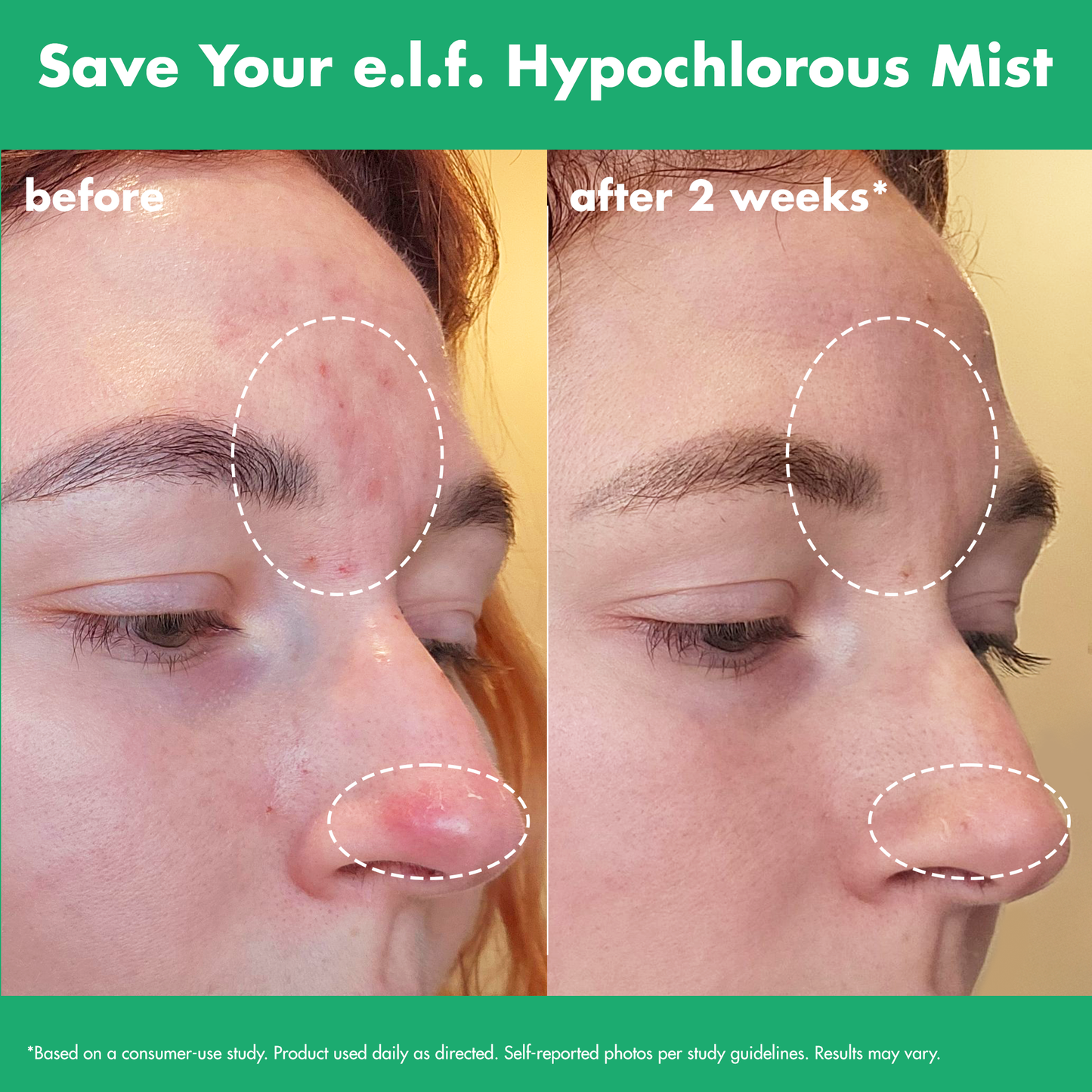 save-your-e-l-f-hypochlorous-mist-n2 FA26_EDUCATION_SAVEYOURELF_USAGE_BA1_WITHOUT_CLAIMS.png