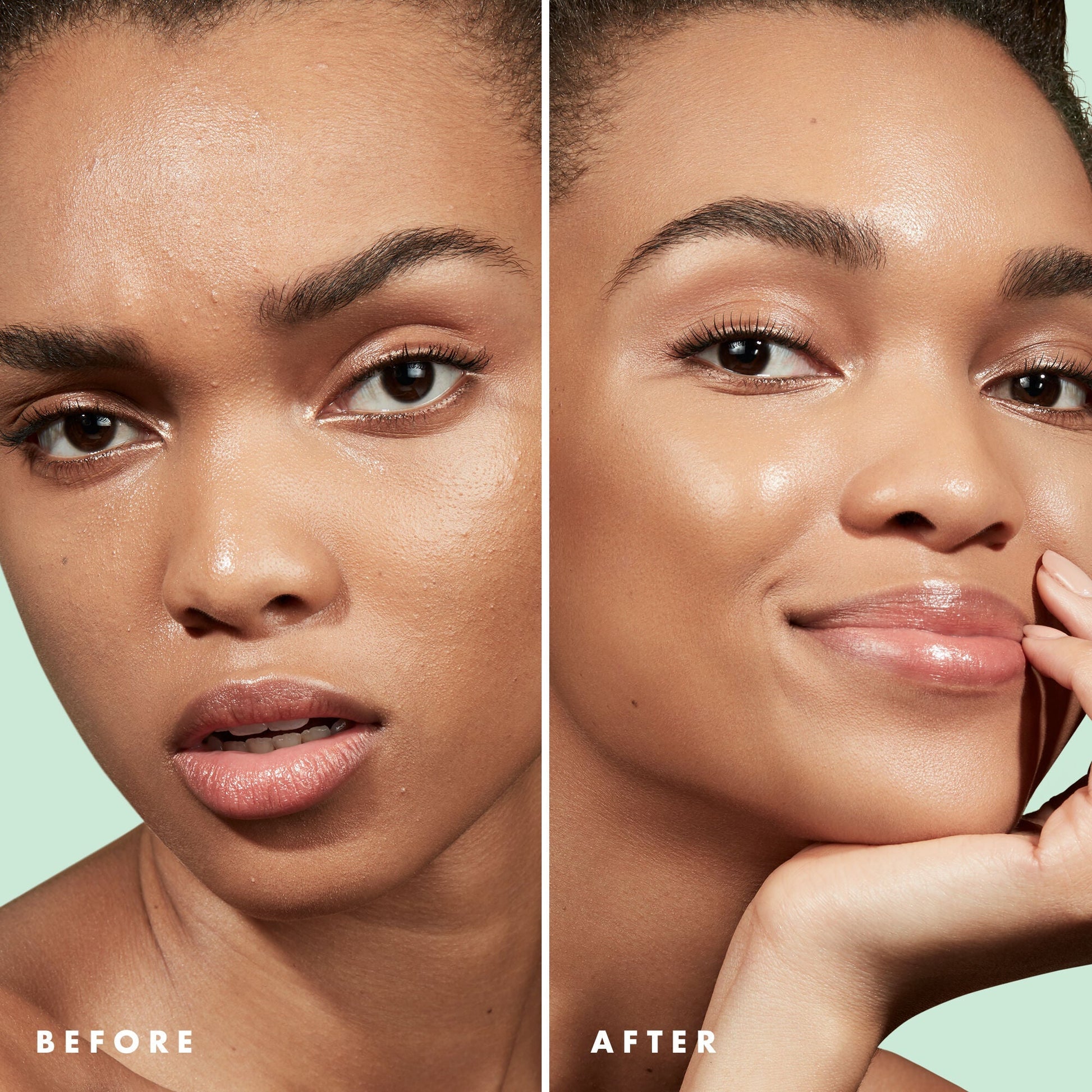 blemish-control-face-primer-large-size-v1 Primer_PP_Before_After_BlemishControl_2000x2000_3774231e-d4e1-49dd-b3d7-a73cbac901fe.jpg